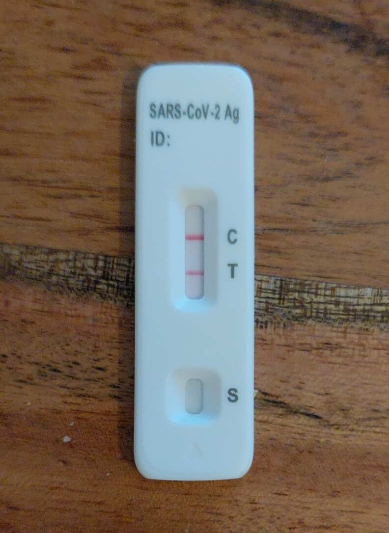 Foto eines positiven Test von SARS-CoV-19